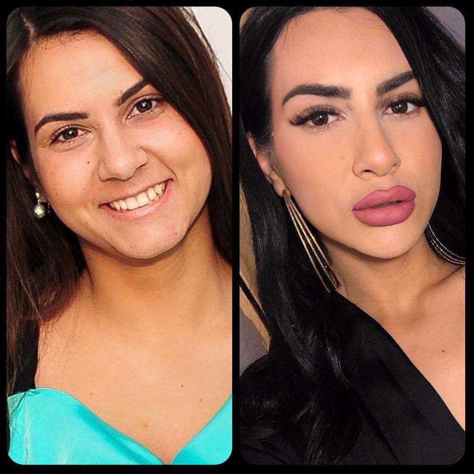 După intervențiile estetice pe care le-a suferit după despărțirea de Ovidiu Popescu, Ada Hululei este nerecunoscut